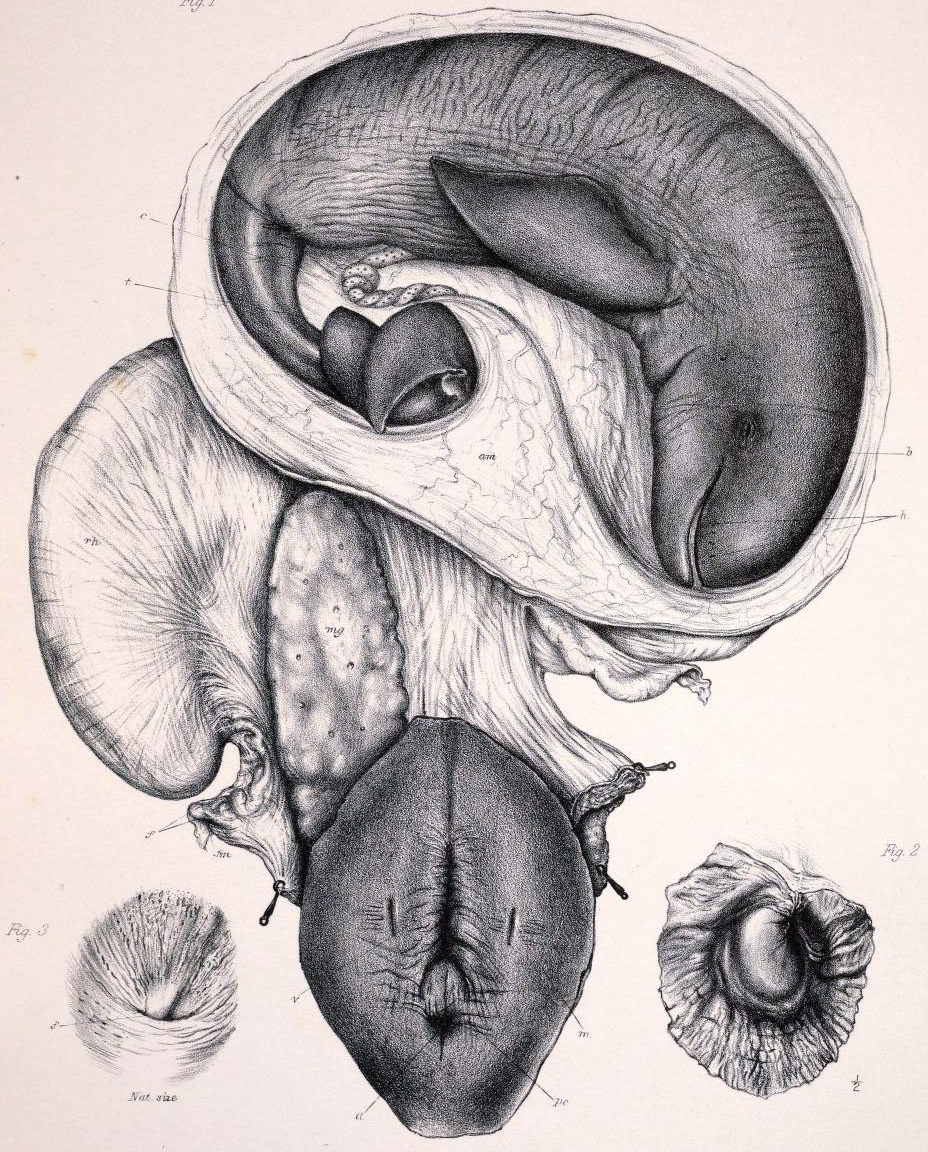 An 1878 drawing of an Irrawaddy dolphin in its mother’s uterus details the smile of this Mekong river wanderer – celebrated as the metamorphosis of a beautiful, dignified maiden.